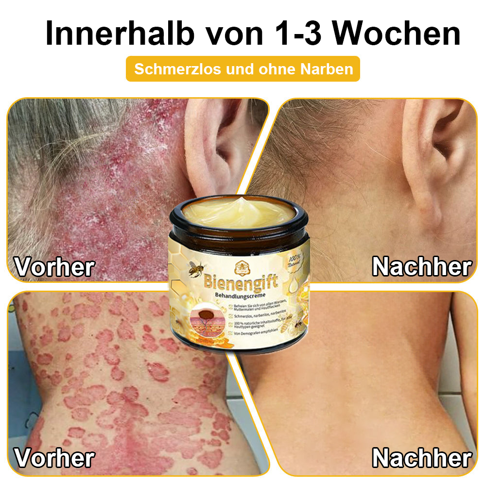 6 Flaschen-Beste Ergebnisse